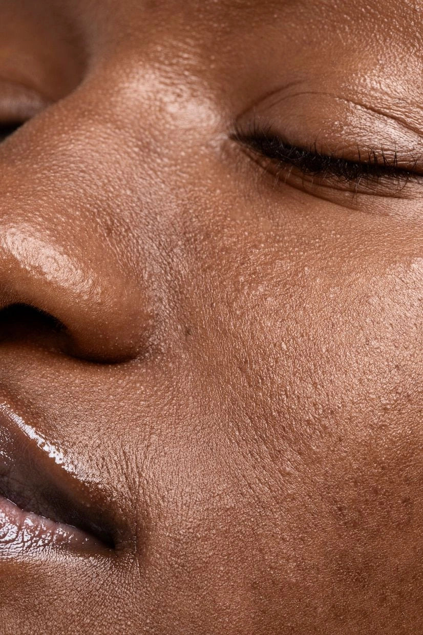Dark Spots